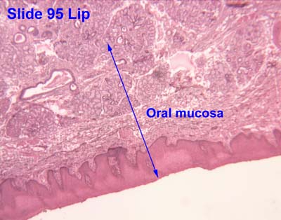 Oral mucosa